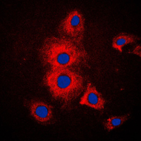 KRT19 / CK19 / Cytokeratin 19 Antibody - Immunofluorescent analysis of Cytokeratin 19 staining in MCF7 cells. Formalin-fixed cells were permeabilized with 0.1% Triton X-100 in TBS for 5-10 minutes and blocked with 3% BSA-PBS for 30 minutes at room temperature. Cells were probed with the primary antibody in 3% BSA-PBS and incubated overnight at 4 C in a humidified chamber. Cells were washed with PBST and incubated with a DyLight 594-conjugated secondary antibody (red) in PBS at room temperature in the dark. DAPI was used to stain the cell nuclei (blue).