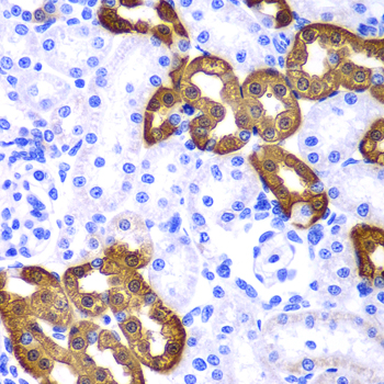 KRT19 / CK19 / Cytokeratin 19 Antibody - Immunohistochemistry of paraffin-embedded rat kidney tissue, with a concentration of 1:100.