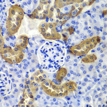 KRT19 / CK19 / Cytokeratin 19 Antibody - Immunohistochemistry of paraffin-embedded mouse kidney tissue, with a concentration of 1:100.