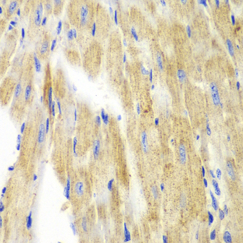 KRT19 / CK19 / Cytokeratin 19 Antibody - Immunohistochemistry of paraffin-embedded mouse heart, with a concentration of 1:100.
