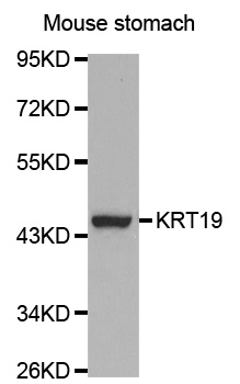 KRT19 / CK19 / Cytokeratin 19 Antibody - Western blot analysis of extracts of mouse stomach, using KRT19 antibody at 1:1000 dilution. The secondary antibody used was an HRP Goat Anti-Rabbit IgG (H+L) at 1:10000 dilution. Lysates were loaded 25ug per lane and 3% nonfat dry milk in TBST was used for blocking. An ECL Kit was used for detection and the exposure time was 120s.