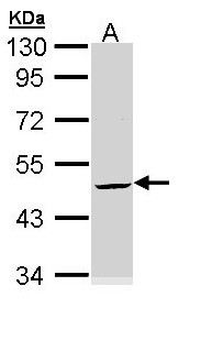 KRT20 / CK20 / Cytokeratin 20 Antibody - Sample (30 ug of whole cell lysate). A: Hela. 10% SDS PAGE. Cytokeratin 20 / Keratin 20 antibody diluted at 1:3000