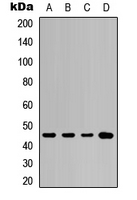 KRT20 / CK20 / Cytokeratin 20 Antibody - Western blot analysis of Cytokeratin 20 expression in A549 (A); NS-1 (B); mouse kidney (C); rat kidney (D) whole cell lysates.
