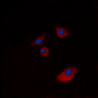 KRT20 / CK20 / Cytokeratin 20 Antibody - Immunofluorescent analysis of Cytokeratin 20 staining in A549 cells. Formalin-fixed cells were permeabilized with 0.1% Triton X-100 in TBS for 5-10 minutes and blocked with 3% BSA-PBS for 30 minutes at room temperature. Cells were probed with the primary antibody in 3% BSA-PBS and incubated overnight at 4 deg C in a humidified chamber. Cells were washed with PBST and incubated with a DyLight 594-conjugated secondary antibody (red) in PBS at room temperature in the dark. DAPI was used to stain the cell nuclei (blue).