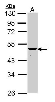 KRT34 / Keratin 34 / KRTHA4 Antibody - Sample (30 ug of whole cell lysate). A: Hela. 10% SDS PAGE. Keratin-34 / KRT34 antibody diluted at 1:1000.