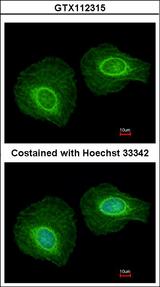 KRT34 / Keratin 34 / KRTHA4 Antibody - Immunofluorescence of methanol-fixed HeLa using Cytokeratin 34 antibody at 1:200 dilution.