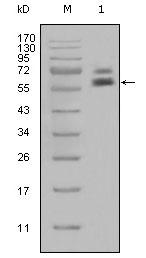 KRT5 / CK5 / Cytokeratin 5 Antibody - Western blot using CK5 mouse monoclonal antibody against HeLa cell lysate (1).
