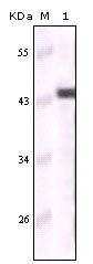 KRT5 / CK5 / Cytokeratin 5 Antibody - Western blot using CK5 mouse monoclonal antibody against truncated CK5 recombinant protein