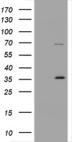 KRT5 / CK5 / Cytokeratin 5 Antibody - HEK293T cells were transfected with the pCMV6-ENTRY control (Left lane) or pCMV6-ENTRY KRT5 (Right lane) cDNA for 48 hrs and lysed. Equivalent amounts of cell lysates (5 ug per lane) were separated by SDS-PAGE and immunoblotted with anti-KRT5.