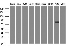 KRT5 / CK5 / Cytokeratin 5 Antibody - Western blot of extracts (35 ug) from 9 different cell lines by using g anti-KRT5 monoclonal antibody (HepG2: human; HeLa: human; SVT2: mouse; A549: human; COS7: monkey; Jurkat: human; MDCK: canine; PC12: rat; MCF7: human).