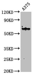 KRT6A / CK6A / Cytokeratin 6A Antibody - Western Blot Positive WB detected in: A375 whole cell lysate All lanes: Krt6a antibody at 4.6µg/ml Secondary Goat polyclonal to rabbit IgG at 1/50000 dilution Predicted band size: 60 kDa Observed band size: 60 kDa
