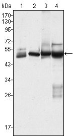 KRT7 / CK7 / Cytokeratin 7 Antibody - Western blot using CK7 mouse monoclonal antibody against HeLa (1), MCF-7 (2), A431 (3) and A549 (4) cell lysate.