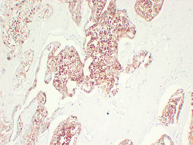 KRT7 / CK7 / Cytokeratin 7 Antibody - Chromophobe Cell Renal Carcinoma