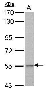 KRT71 / Keratin 71 Antibody - Sample (30 ug of whole cell lysate) A: HepG2 7.5% SDS PAGE KRT71 antibody diluted at 1:5000