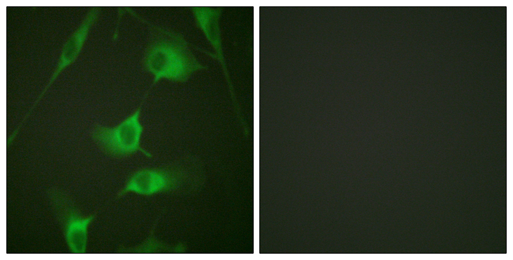 KRT8 / CK8 / Cytokeratin 8 Antibody - Immunofluorescence analysis of HeLa cells, using Keratin 8 Antibody. The picture on the right is blocked with the synthesized peptide.