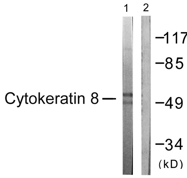 KRT8 / CK8 / Cytokeratin 8 Antibody - Western blot analysis of lysates from 293 cells, treated with EGF 200ng/ml 30', using Keratin 8 Antibody. The lane on the right is blocked with the synthesized peptide.
