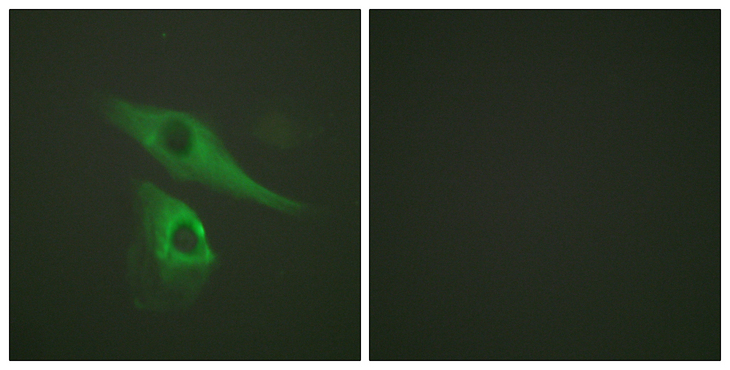 KRT8 / CK8 / Cytokeratin 8 Antibody - Immunofluorescence analysis of HeLa cells, using Keratin 8 Antibody. The picture on the right is blocked with the synthesized peptide.