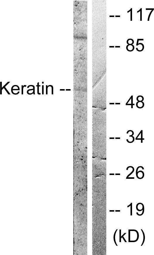 KRT8 / CK8 / Cytokeratin 8 Antibody - Western blot analysis of lysates from HeLa cells, treated with Anisomycin 25ug/ml 30', using Keratin 8 Antibody. The lane on the right is blocked with the synthesized peptide.