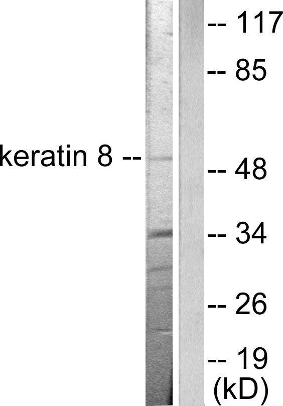 KRT8 / CK8 / Cytokeratin 8 Antibody - Western blot analysis of lysates from SKOV3 cells, using Keratin 8 Antibody. The lane on the right is blocked with the synthesized peptide.