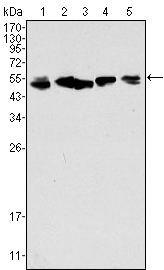 KRT8 / CK8 / Cytokeratin 8 Antibody - Western blot using CK8 mouse monoclonal antibody against A549 (1), HeLa (2), MCF-7 (3), A431 (4) and HepG2 (5) cell lysate.