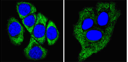 KRT8 / CK8 / Cytokeratin 8 Antibody - Confocal immunofluorescence of methanol-fixed ECA109 cells (left) and HepG2 cells (right) using CK8 mouse monoclonal antibody (green), showing cytoplasmic localization. Blue: DRAQ5 fluorescent DNA dye.