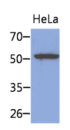 KRT8 / CK8 / Cytokeratin 8 Antibody - Western Blot: The cell lysates of HeLa (40 ug) were resolved by SDS-PAGE, transferred to PVDF membrane and probed with anti-human KRT8 antibody (1:1000). Proteins were visualized using a goat anti-mouse secondary antibody conjugated to HRP and an ECL detection system.