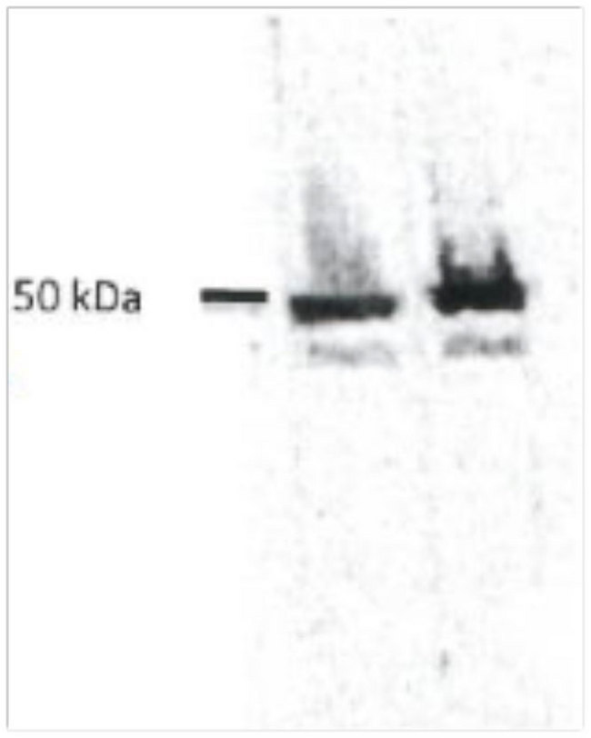 KRT8 / CK8 / Cytokeratin 8 Antibody - Immunoblotting results with KRT8 / CK8 / Cytokeratin 8 on a lysate from HeLa cell culture, showing a strong positive result for antibody dilutions between 1:500 and 1:1000. The antibody recognizes a protein with the correct molecular weight (keratin 8; approximately 50 kDa).