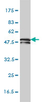 KRT81 / Keratin 81 / KRTHB1 Antibody - KRTHB1 monoclonal antibody clone 3B10-5B10 Western blot of KRTHB1 expression in HepG2.