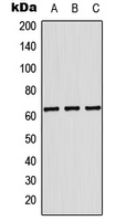 KRT84 / Keratin 84 / KRTHB4 Antibody - Western blot analysis of Cytokeratin 84 expression in THP1 (A); Raw264.7 (B); PC12 (C) whole cell lysates.