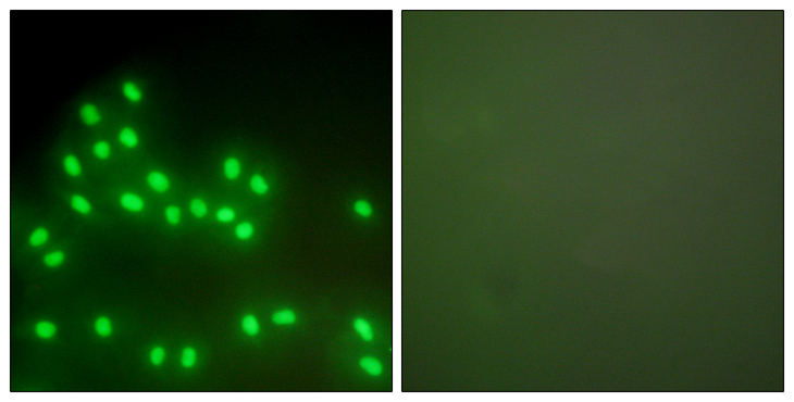 Ku70+Ku80 / XRCC6+XRCC5 Antibody - Immunofluorescence analysis of A549 cells, using Ku70/80 Antibody. The picture on the right is blocked with the synthesized peptide.
