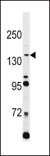 L1CAM Antibody - L1CAM Antibody western blot of Jurkat cell line lysates (35 ug/lane). The L1CAM antibody detected the L1CAM protein (arrow).
