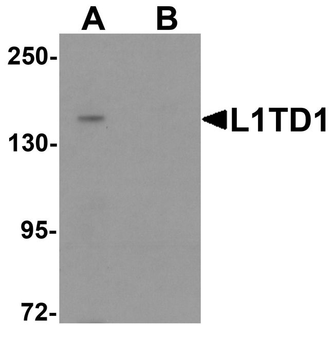 L1TD1 Antibody - Western blot analysis of L1TD1 in Jurkat cell lysate with L1TD1 antibody at 1 ug/ml in (A) the absence and (B) the presence of blocking peptide.
