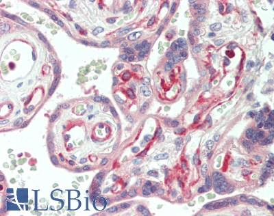 LAMA4 / Laminin Alpha 4 Antibody - Human Placenta: Formalin-Fixed, Paraffin-Embedded (FFPE)
