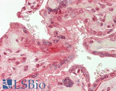 LAMA5 / Laminin Alpha 5 Antibody - Human Placenta: Formalin-Fixed, Paraffin-Embedded (FFPE)