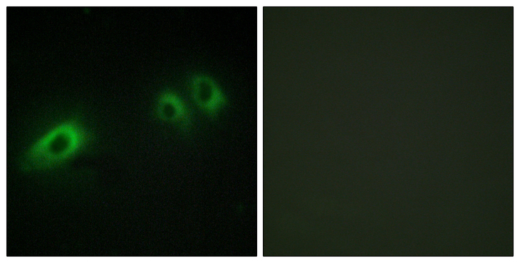 LAMB1 / Laminin Beta 1 Antibody - Immunofluorescence analysis of HeLa cells, using LAMB1 Antibody. The picture on the right is blocked with the synthesized peptide.