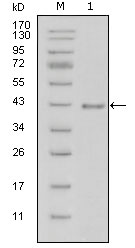 LAMB1 / Laminin Beta 1 Antibody - Western blot using LAMB1 mouse monoclonal antibody against truncated LAMB1-His recombinant protein (1).