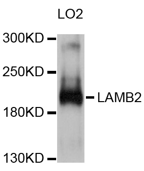 LAMB2 / Laminin Beta 2 Antibody - Western blot analysis of extracts of LO2 cells, using LAMB2 antibody at 1:1000 dilution. The secondary antibody used was an HRP Goat Anti-Rabbit IgG (H+L) at 1:10000 dilution. Lysates were loaded 25ug per lane and 3% nonfat dry milk in TBST was used for blocking. An ECL Kit was used for detection and the exposure time was 5s.