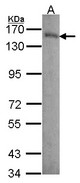 LAMB3 / Laminin Beta 3 Antibody - Sample (30 ug of whole cell lysate). A: A431 . 7.5% SDS PAGE. Laminin beta-3 antibody. Laminin Beta-3 / LAMB3 antibody diluted at 1:1000.