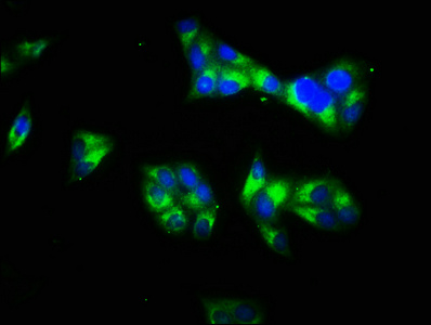 LAMC1 / Laminin Gamma 1 Antibody - Immunofluorescence staining of Hela cells with LAMC1 Antibody at 1:66, counter-stained with DAPI. The cells were fixed in 4% formaldehyde, permeabilized using 0.2% Triton X-100 and blocked in 10% normal Goat Serum. The cells were then incubated with the antibody overnight at 4°C. The secondary antibody was Alexa Fluor 488-congugated AffiniPure Goat Anti-Rabbit IgG(H+L).