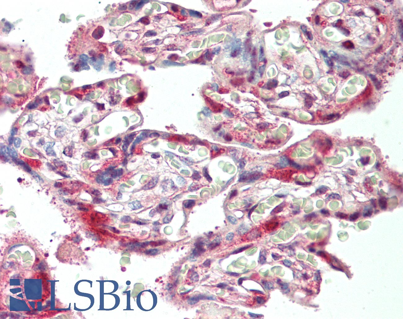 Laminin Antibody - Anti-Laminin antibody IHC staining of human placenta. Immunohistochemistry of formalin-fixed, paraffin-embedded tissue after heat-induced antigen retrieval.