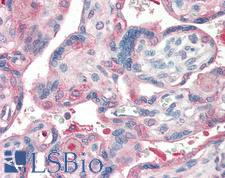 Laminin Antibody - Anti-Laminin antibody IHC of human placenta. Immunohistochemistry of formalin-fixed, paraffin-embedded tissue after heat-induced antigen retrieval. Antibody concentration 5 ug/ml.