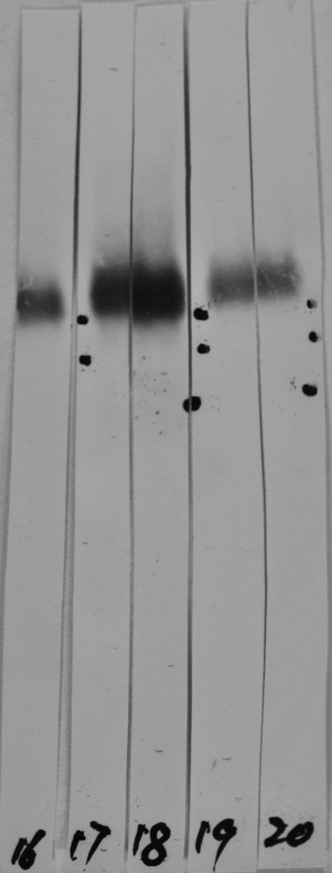 LAMP1 / CD107a Antibody - Western strip blots of HeLa cell crude extracts with two different preparations of CD107a / LAMP1 antibody in strips 17 and 18. Both preparations bind to a diffuse band running at between ~90kDa and ~120kDa as expected, and show no appreciably cross reactivity with any other protein.