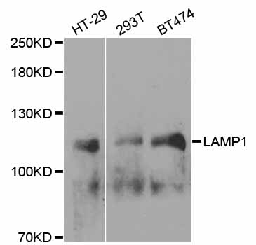 LAMP1 / CD107a Antibody - Western blot analysis of extracts of various cell lines, at a dilution of 1:1000.