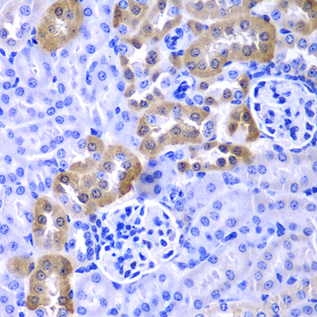 LAMP1 / CD107a Antibody - Immunohistochemistry of paraffin-embedded mouse kidney tissue, at a dilution of 1:100. 