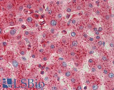 LAMP1 / CD107a Antibody - Human Liver: Formalin-Fixed, Paraffin-Embedded (FFPE), at a dilution of 1:100. 