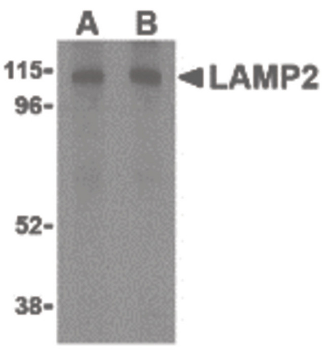 LAMP2 / CD107b Antibody - Western blot of LAMP-2 in HepG2 cell lysate with LAMP-2 antibody at (A) 1 and (B) 2 ug/ml.