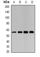 LAP3 Antibody - Western blot analysis of LAP3 expression in SW620 (A); HL60 (B); mouse liver (C); mouse heart (D) whole cell lysates.