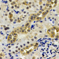 LAP3 Antibody - Immunohistochemical analysis of LAP3 staining in rat kidney formalin fixed paraffin embedded tissue section. The section was pre-treated using heat mediated antigen retrieval with sodium citrate buffer (pH 6.0). The section was then incubated with the antibody at room temperature and detected using an HRP conjugated compact polymer system. DAB was used as the chromogen. The section was then counterstained with hematoxylin and mounted with DPX.