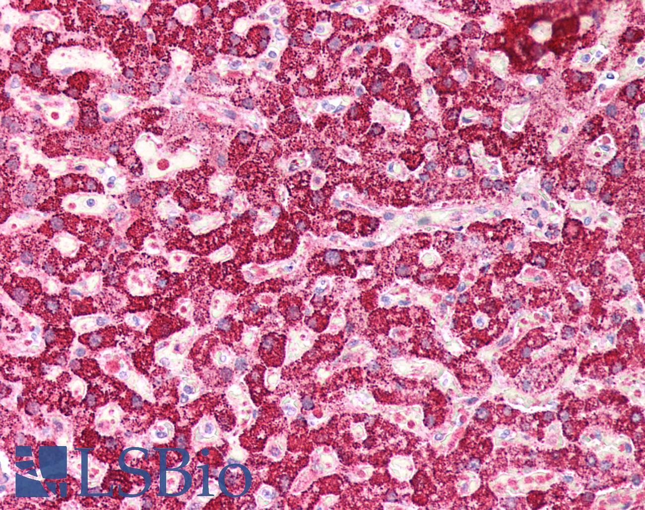 LAP3 Antibody - Human Liver: Formalin-Fixed, Paraffin-Embedded (FFPE)