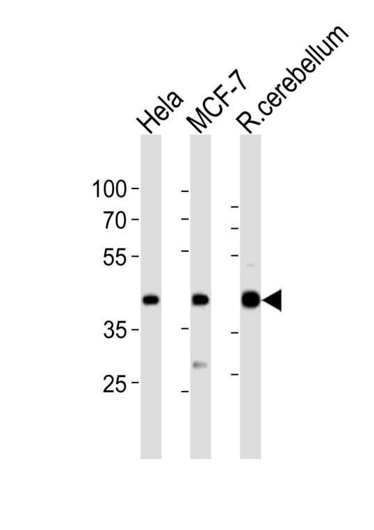 LAPTM4B Antibody - Western blot of lysates from HeLa, MCF-7 cell line, rat cerebellum tissue lysate (from left to right) with LAPTM4B Antibody (4). Antibody was diluted at 1:1000 at each lane. A goat anti-rabbit IgG H&L (HRP) at 1:10000 dilution was used as the secondary antibody. Lysates at 20 ug per lane.